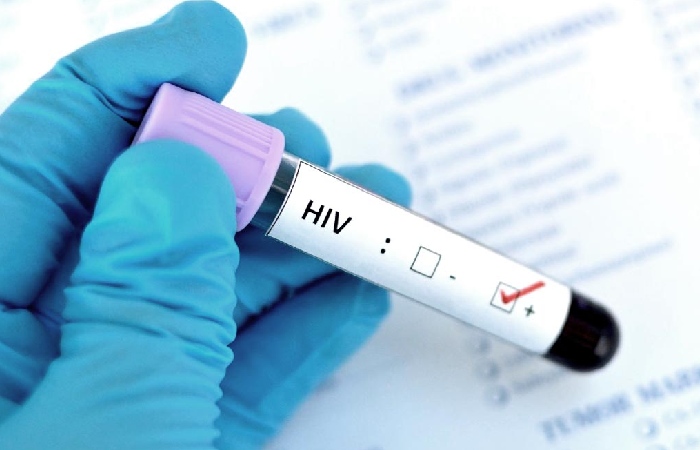 How to Maintain a Safe Relationship with a Person with AIDS?